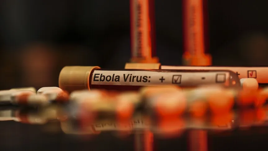ABD’de bazı havalimanlarında 2026 Dünya Kupası öncesi kurulan Ebola tarama merkezlerinden biri