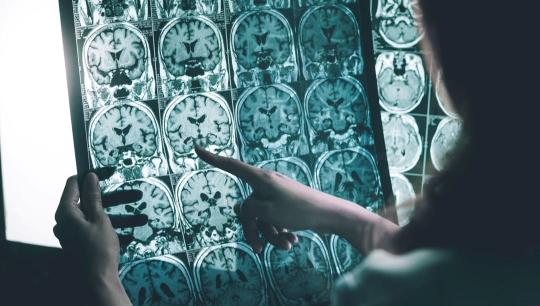 Stresli işlere karşı elektronik dövme: Fazla çalışınca alarm veriyor – Son Dakika Dünya Haberleri