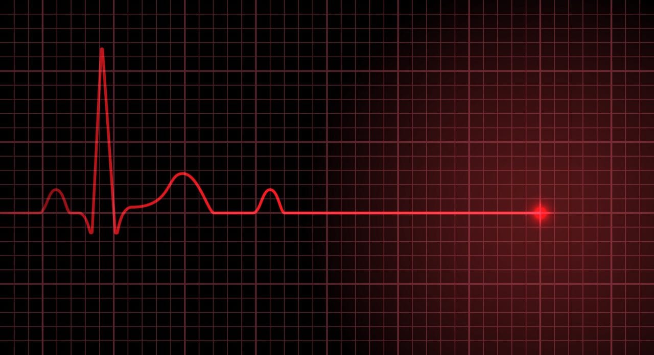 İskele’de havuzda boğulma tehlikesi geçiren 4 yaşındaki çocuk kurtarılamayarak yaşamını yitirdi – BRTK