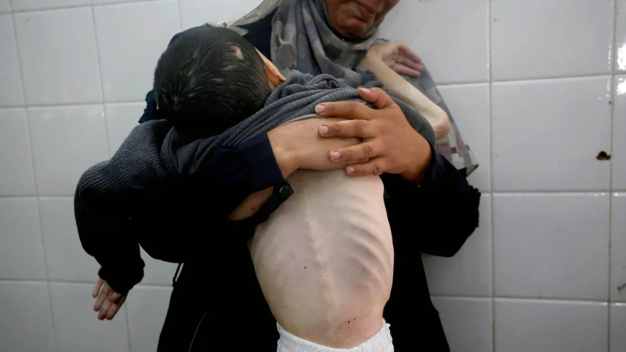 Gazze’de açlıktan ölenlerin sayısı 339’a çıktı