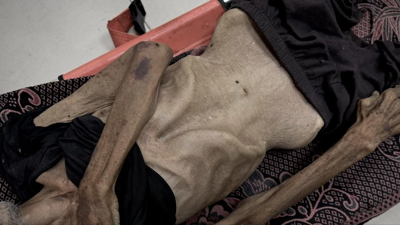 Soykırımın yeni yüzü: Kıtlık – Son Dakika Haberleri