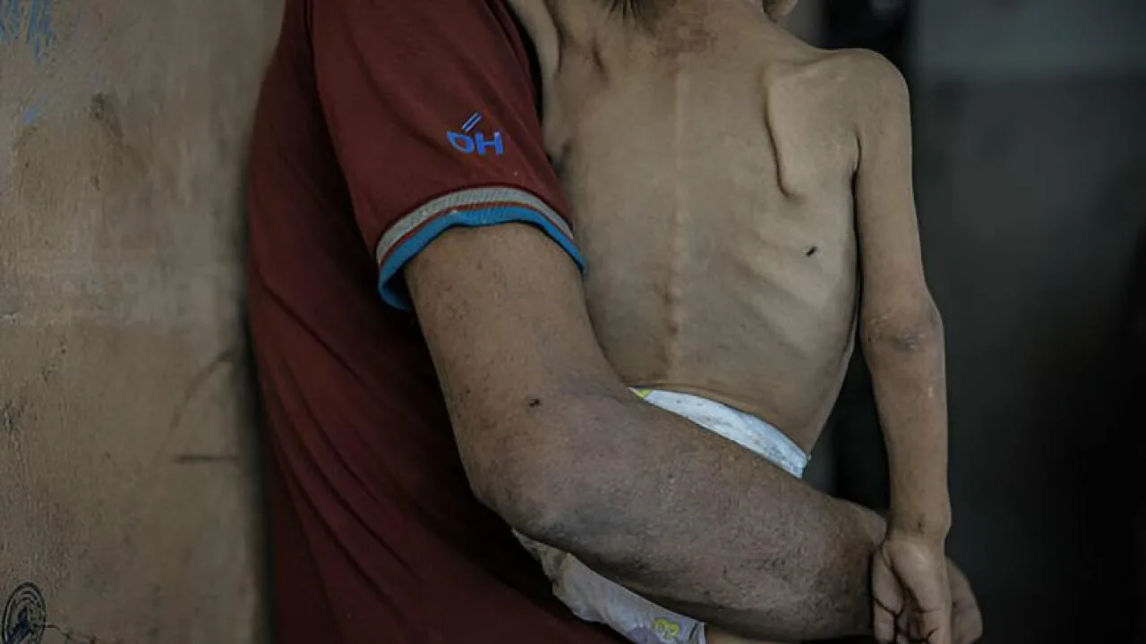 İsrail’in kıtlığı dayattığı Gazze’de açlıktan ölenlerin sayısı 263’e yükseldi