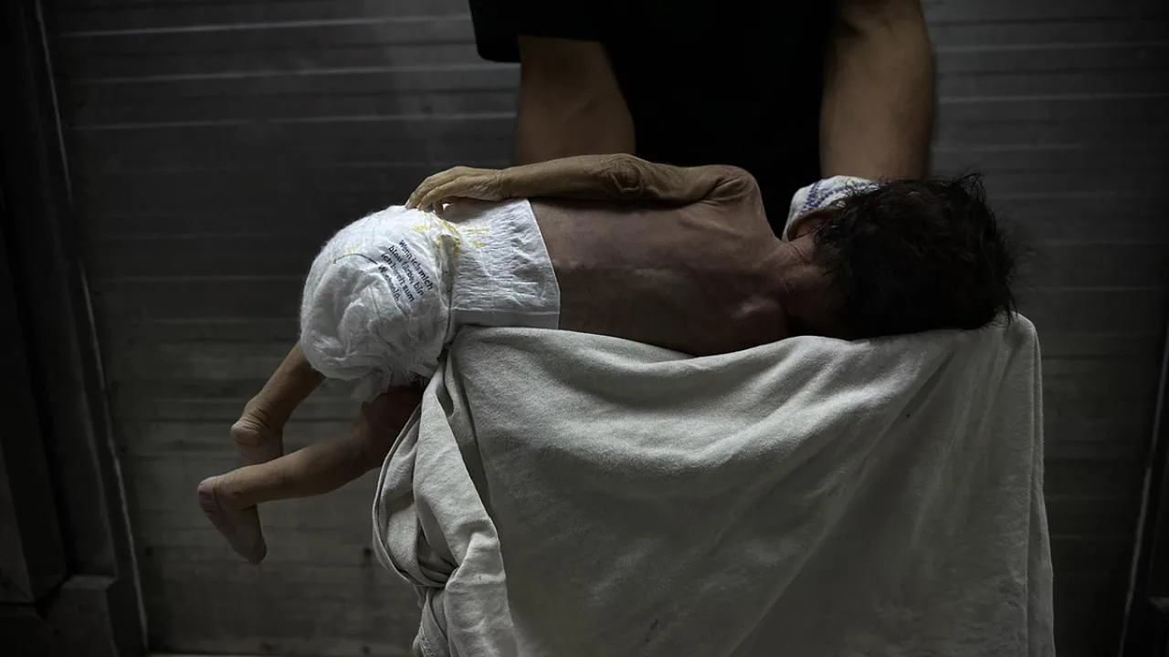 Gazze’nin bebekleri açlıktan ölüyor – Son Dakika Haberleri